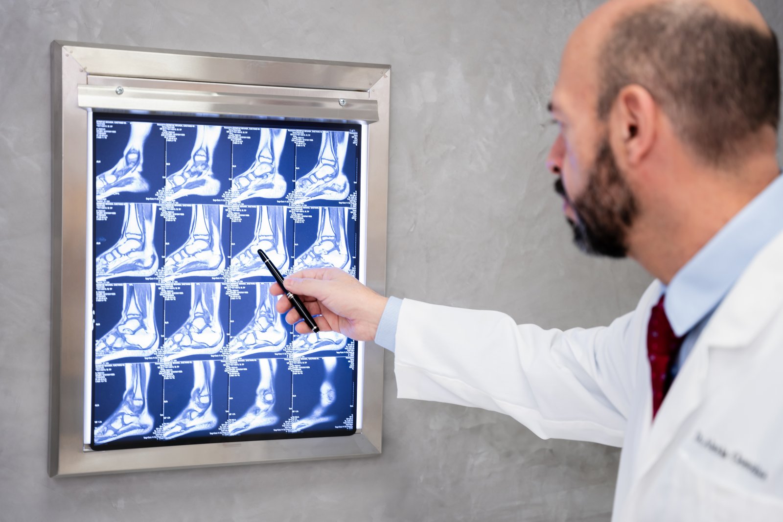 Traumatología